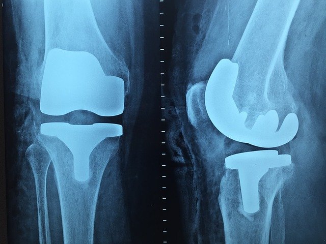 ENDO-Clinic: Ortho Fast Track recovery