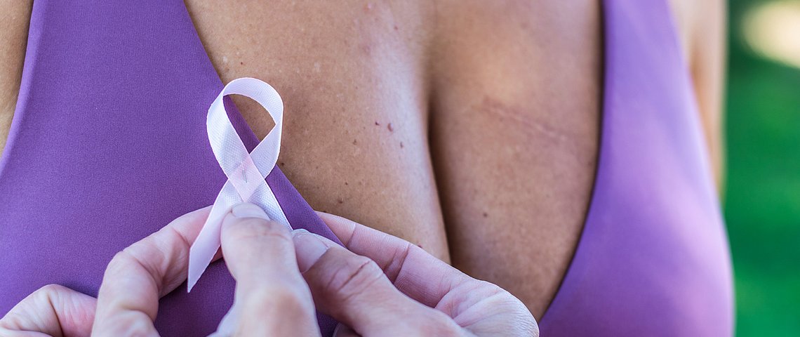 Mastectomy: Information on breast removal