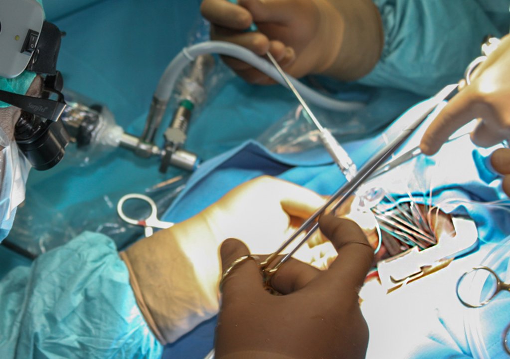Minimally invasive procedures facilitate complex heart operations