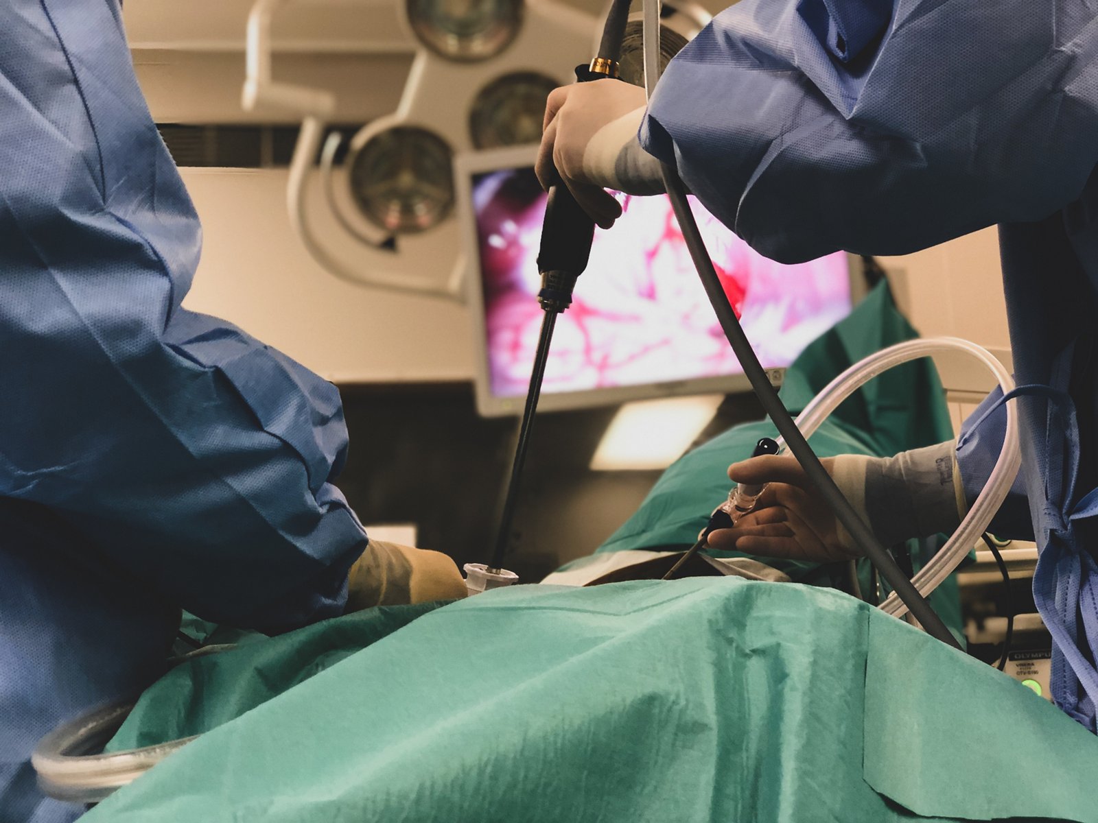 Pancreatic cancer treatment: Modern methods and treatment options